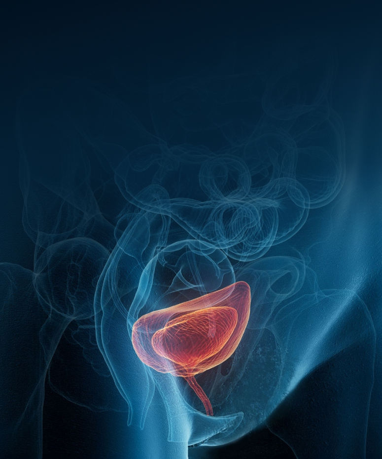 배뇨장애 클리닉