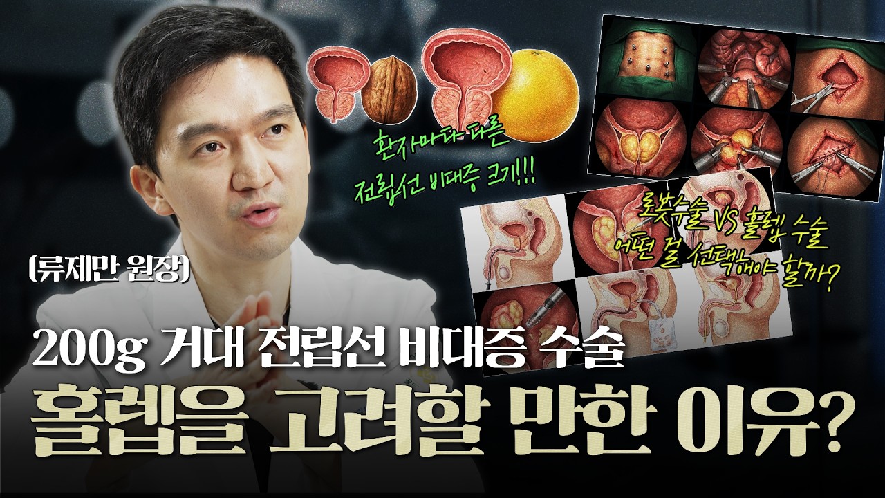 200g에 달하는 거대 전립선비대증! 홀렙을 고려할만한 이유가 있다?_이미지