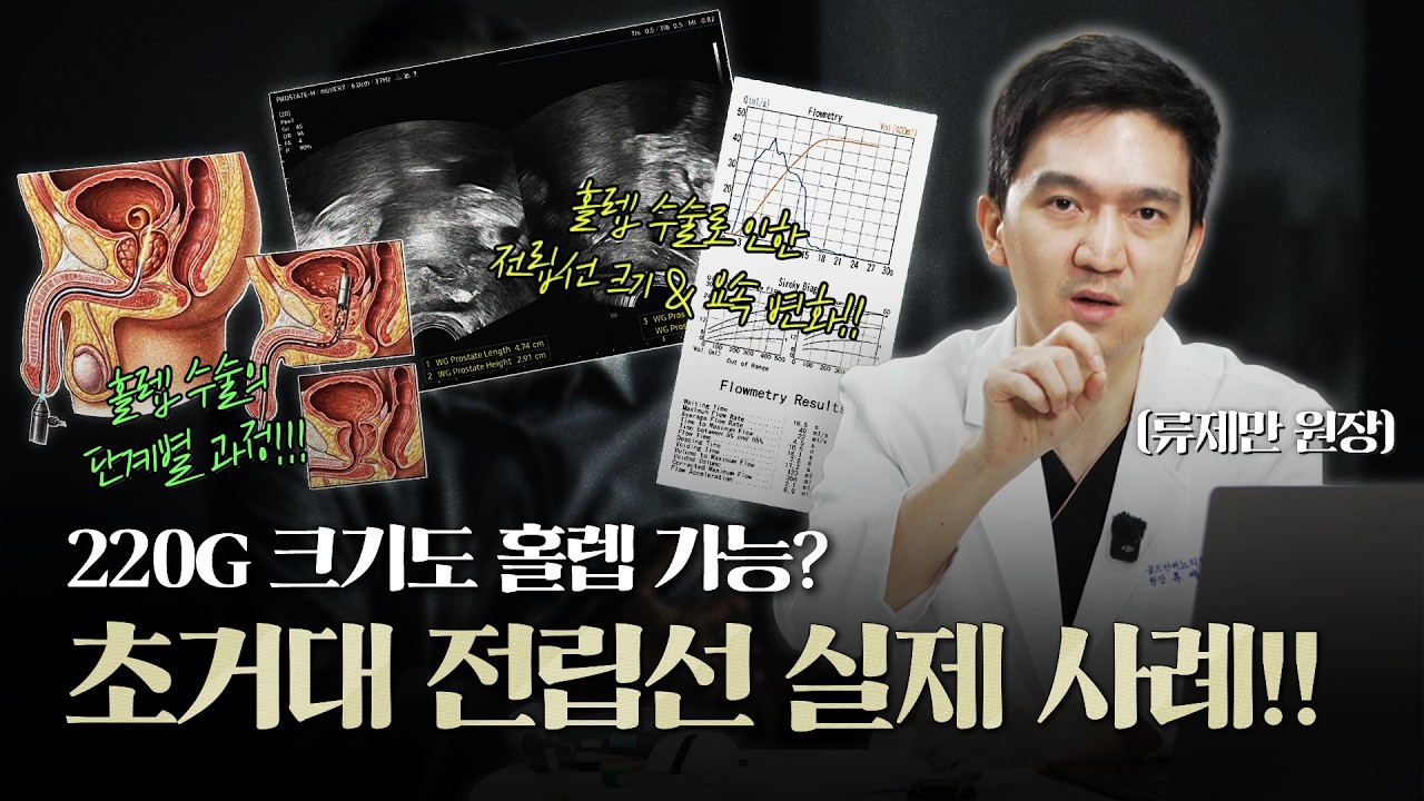 220g에 달하는 초거대 전립선비대증 환자! 홀렙 수술할 수 있을까? 효과는?_이미지