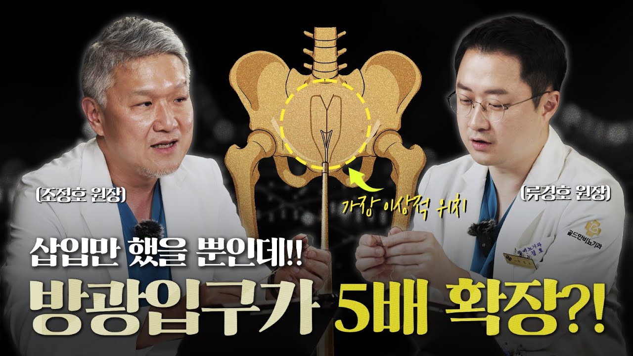 전립선비대 아이틴드(iTind)수술, 스텐트를 삽입만 했을 뿐인데 방광입구를 5배나 확장하는 효과가? (일시적 니티놀 삽입술) [류경호, 조정호 원장님의 아이틴드 2편]_이미지