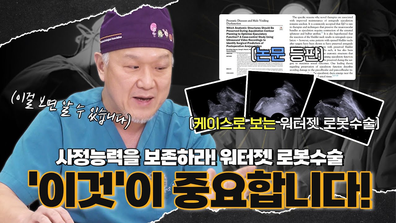 사정능력을 보존하라! 워터젯 로봇수술(아쿠아블레이션)로 사정능력 보존하려면 '이것'이 중요합니다!_이미지