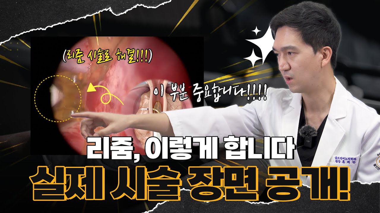 리줌 시술은 이렇게 합니다. 실제 시술 장면 공개!_이미지