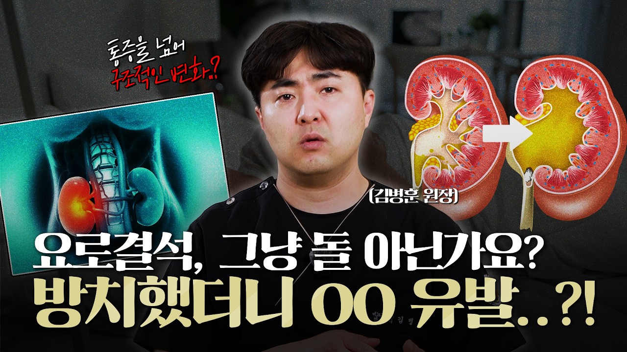 요로결석, 그냥 돌 아닌가요? 방치했더니 신장에 치명적인 영향까지?_이미지