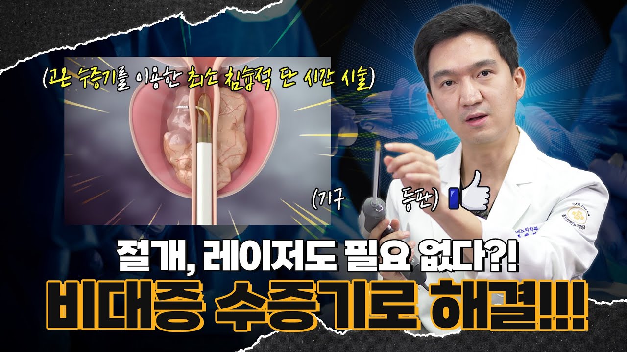 절개, 레이저도 필요없다? 전립선 비대증 수증기로 해결! (리줌시술)