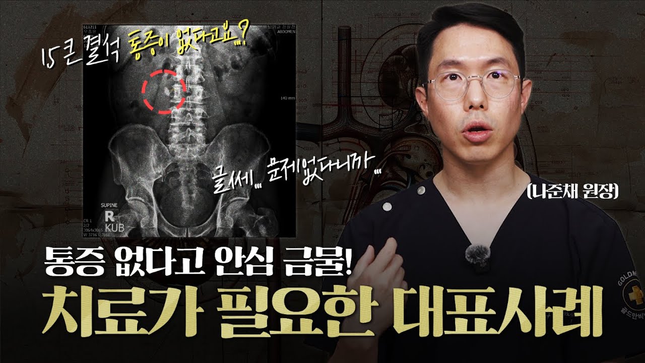 통증 없다고 안심하시면 안됩니다! 신장결석, 이런 경우 치료가 필요합니다(신장 결석 치료 사례 1편)_이미지