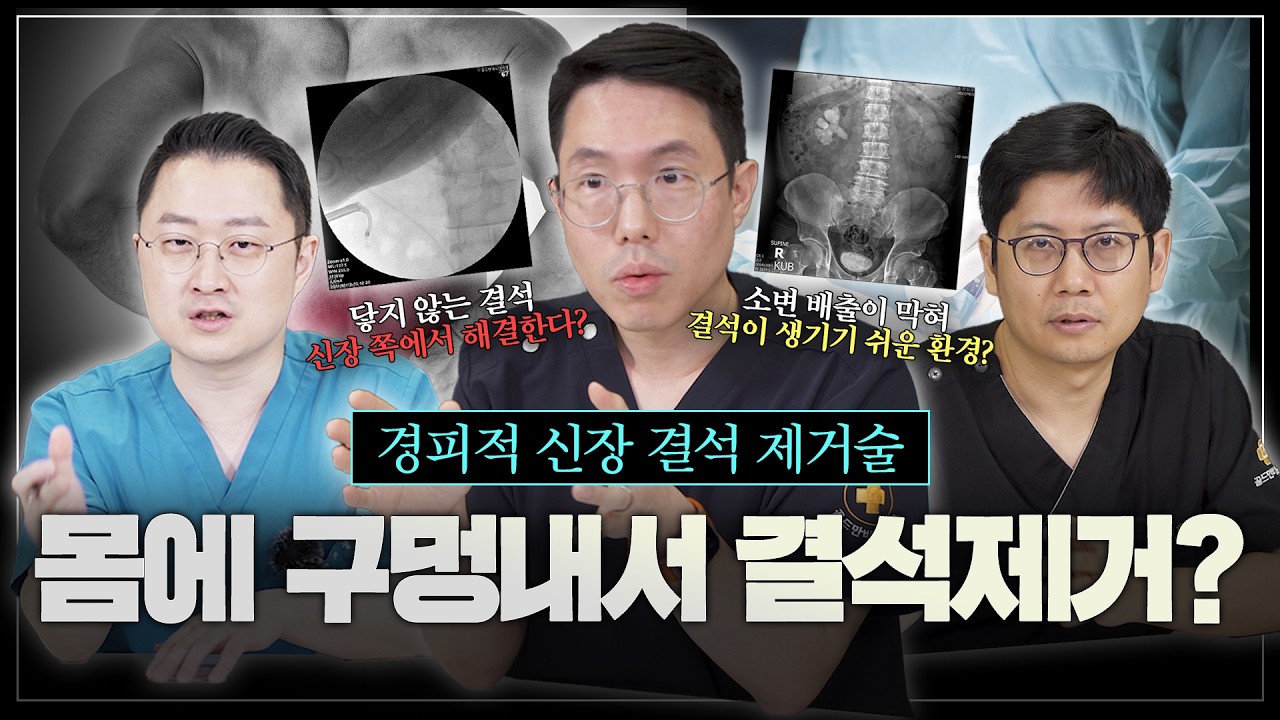 옆구리에 구멍을 내서 신장 결석을 제거한다구요? 경피적 신장 결석 제거술 PCNL 2편_이미지