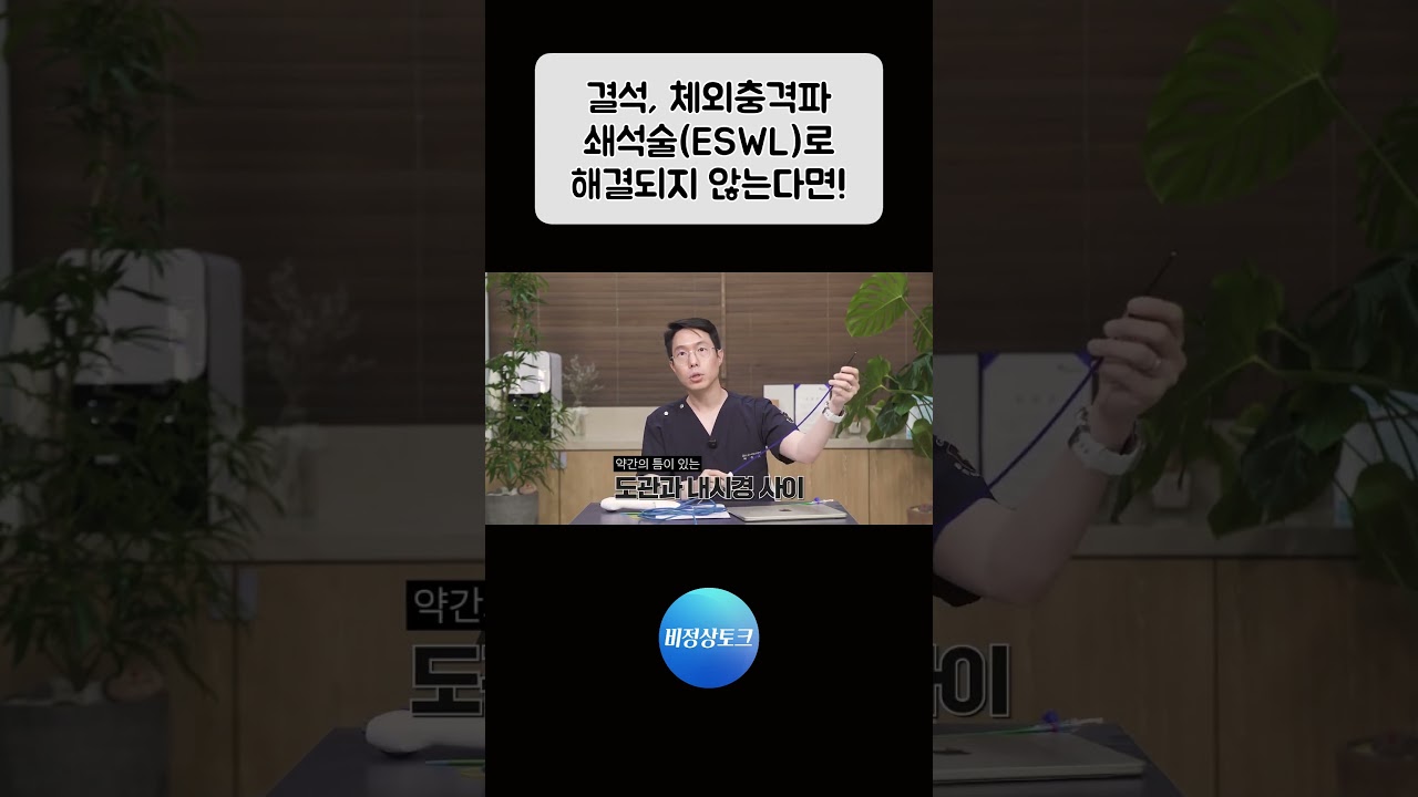 결석, 체외충격파 쇄석술(ESWL)로 해결되지 않는다면!_이미지