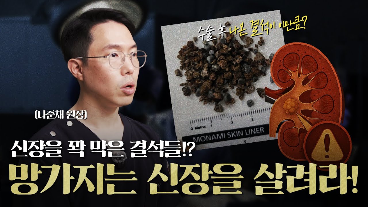 신장을 꽉막은 결석들! 망가지는 신장을 살려라(신장결석 치료 사례 2편)_이미지