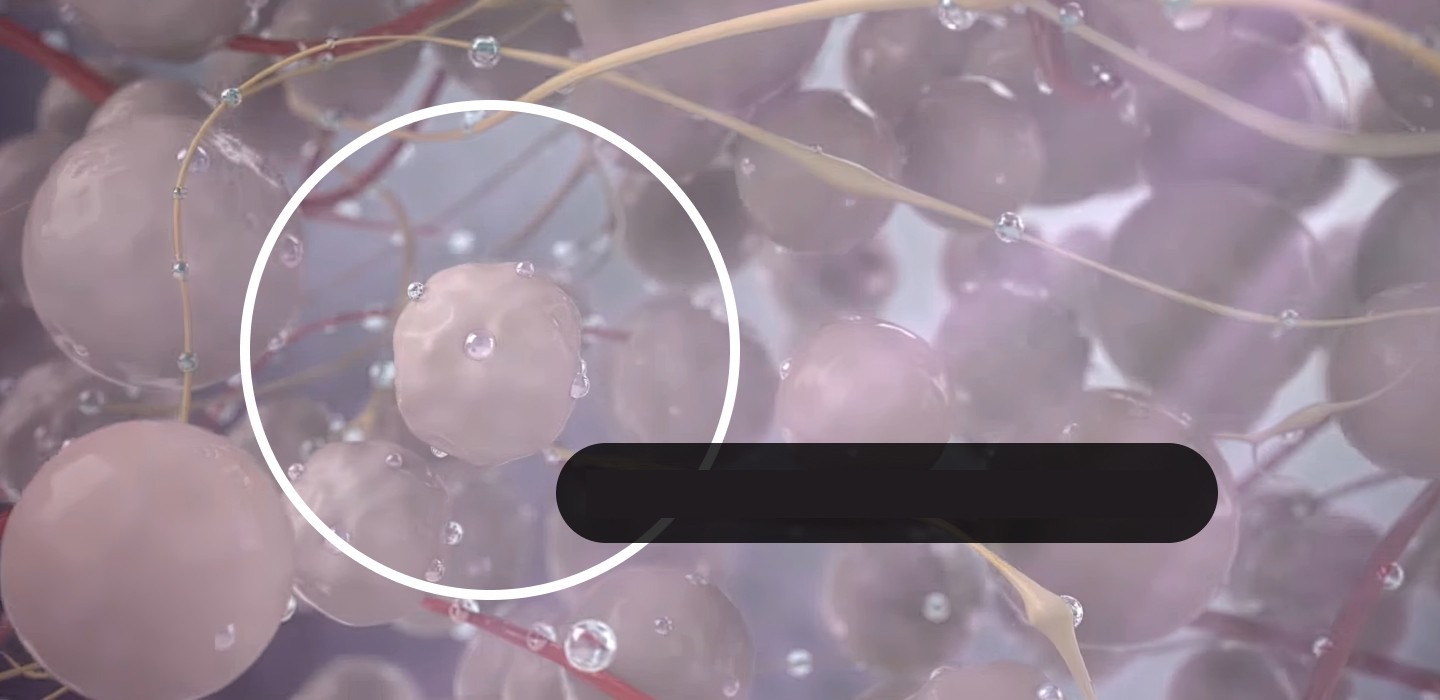 Enlarged tissue being necrosed by steam