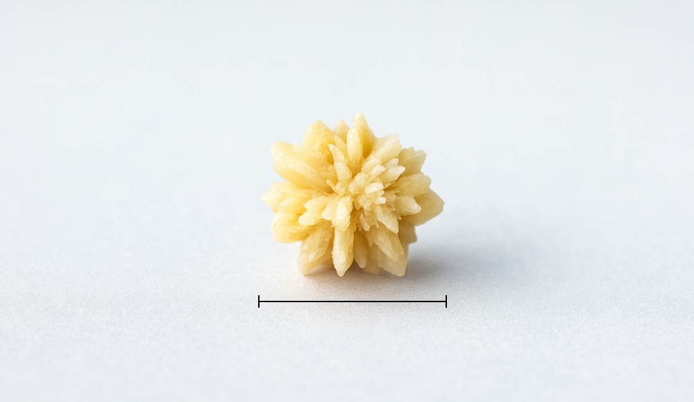 Kidney Stones