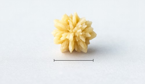 Kidney Stones