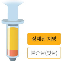 흡입한 지방을 원심분리기에 투입해 순수 지방만 채취