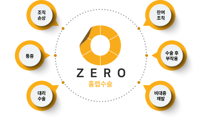 ZERO 홀렙수술 6가지 특징