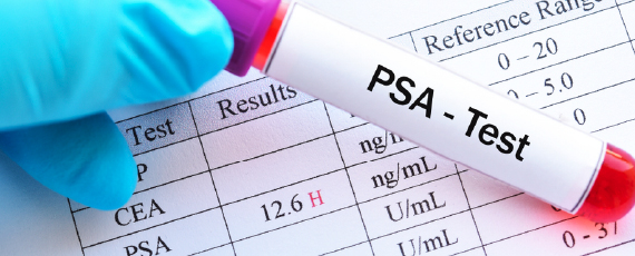 전립선 특이항원 검사(PSA)