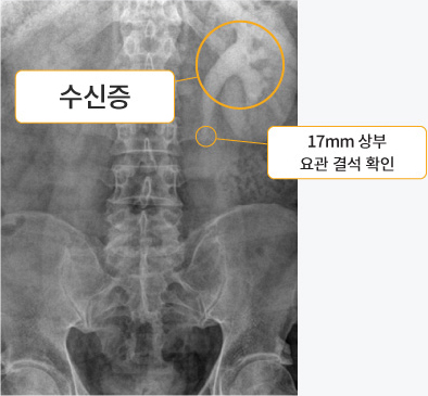 초음파 검사