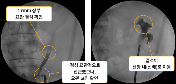 수술 중 C-arm 확인