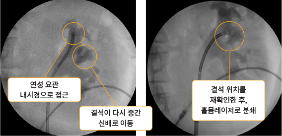 수술 중 C-arm 확인