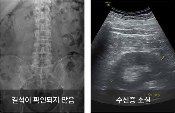 수술 중 C-arm 확인