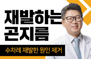 재발하는 곤지름 - 수차례 재발한 원인 제거