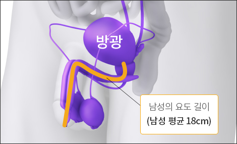 남성의 요도 길이 18cm