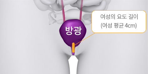 여성 비뇨기 구조의 특수성