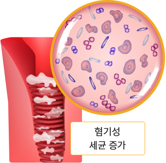 협기성 세균 증가