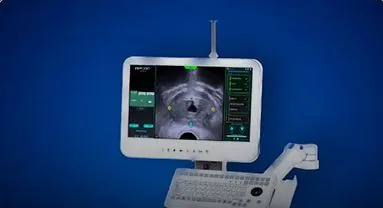 Early adoption of AI robotics and precision resection expertise