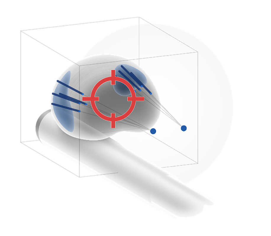Goldman MR Fusion Biopsy