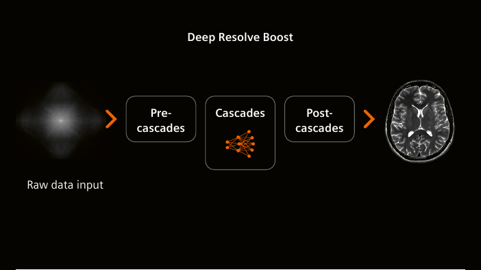 AI 딥러닝 영상 재구성 구조도 (Deep Resolve)
