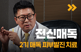 2기 매독 피부 발진 치료제, 천신매독