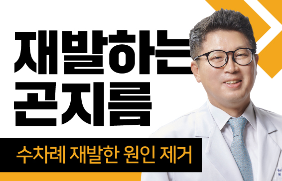 재발성 곤지름, 원인 제거 필요