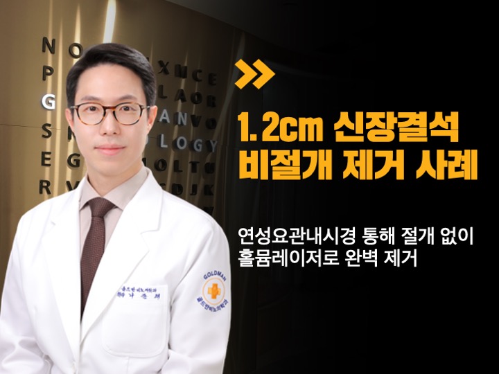 1.2cm 신장결석 비절개 제거 사례연성요관내시경, 홀뮴레이저 시술