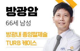 방광암 치료증례 - 골드만비뇨의학과 이창기 원장